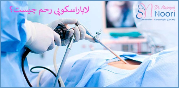لاپاراسکوپی رحم چیست؟