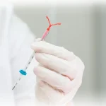 تعبیه دستگاه IUD