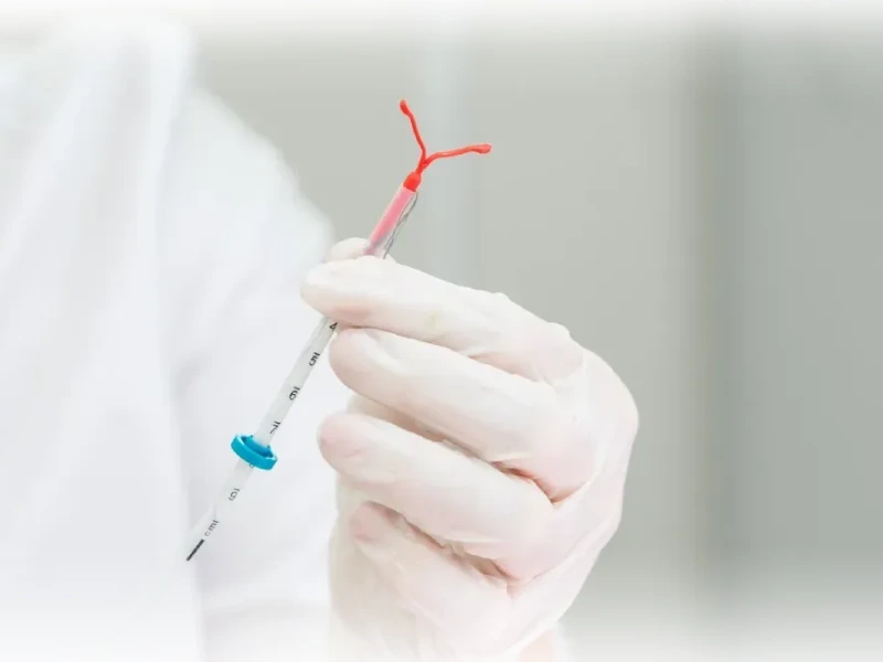 تعبیه دستگاه IUD