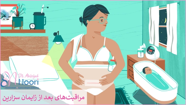 مراقبت‌های بعد از سزارین