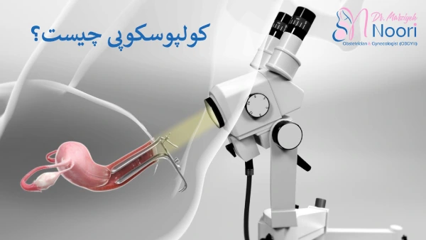 کولپوسکوپی 