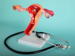 درمان ناباروری با هیستروسکوپی