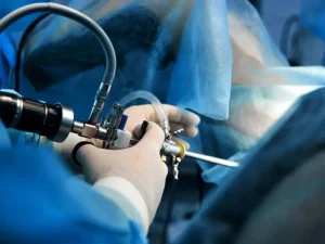 بارداری بعد از هیستروسکوپی