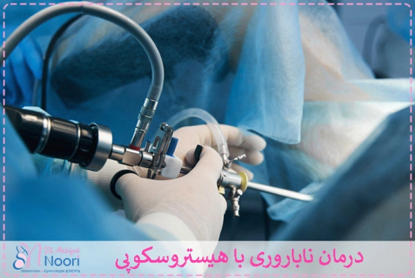 درمان ناباروری با هیستروسکوپی