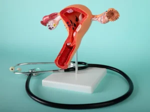 بهترین متخصص هیستروسکوپی در تهران