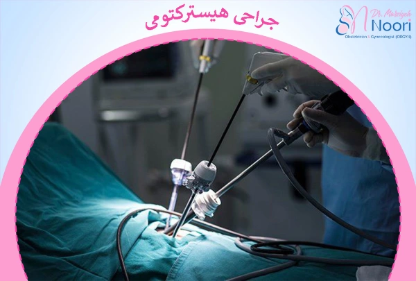 عمل هیسترکتومی