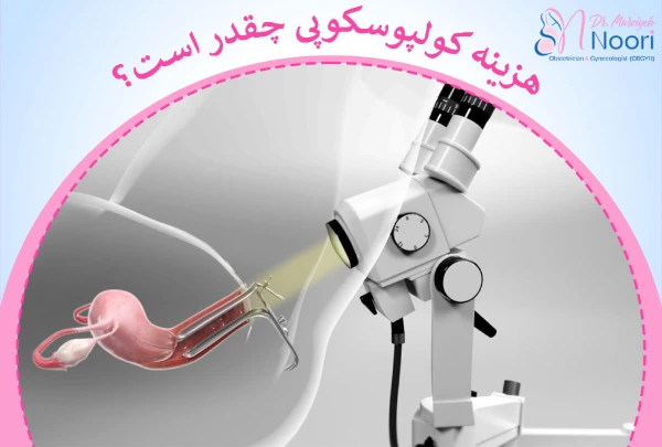 هزینه کولپوسکوپی