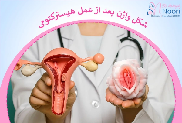 تغییر شکل واژن بعد از عمل هیسترکتومی