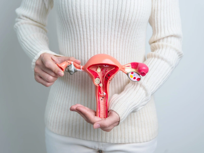 ترشحات واژن بعد از هیسترکتومی