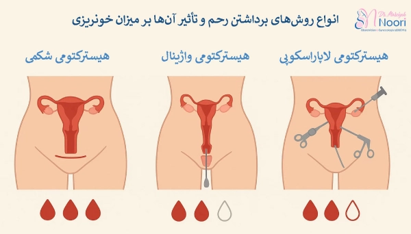 انواع روشهای برداشتن رحم و تأثیر آنها بر میزان خونریزی