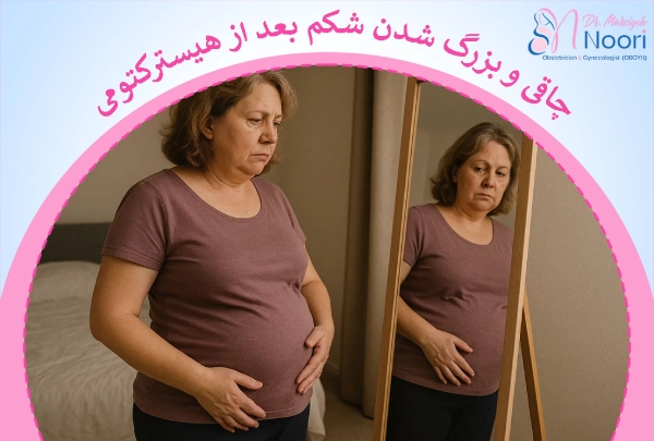 چاقی بعد از هیسترکتومی
